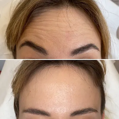 Bednarek Clinic - Szczecin lekarz medycyny estetycznej, kosmetolog, plastyka powiek, leczenie nadwagi i otyłości, botoks